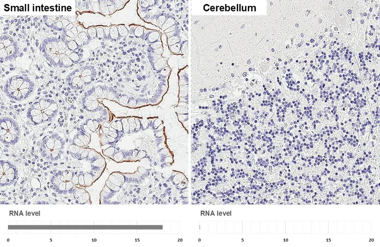 Immunohistochemistry (Formalin/PFA-fixed paraffin-embedded sections) - Anti-GPRC5A antibody [HL1864] - BSA and Azide free (AB325861)