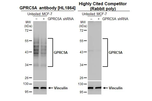 Western blot - Anti-GPRC5A antibody [HL1864] - BSA and Azide free (AB325861)