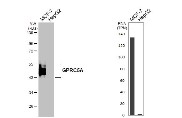 Western blot - Anti-GPRC5A antibody [HL1864] - BSA and Azide free (AB325861)