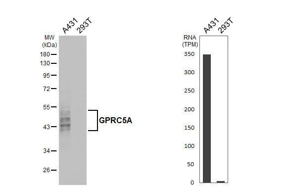 Western blot - Anti-GPRC5A antibody [HL1864] - BSA and Azide free (AB325861)