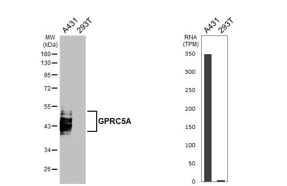 Western blot - Anti-GPRC5A antibody [HL3393] - BSA and Azide free (AB325862)