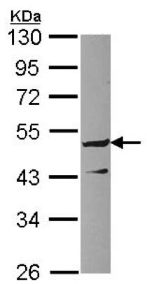 Western blot - Anti-GPRC5C antibody - C-terminal (AB137482)