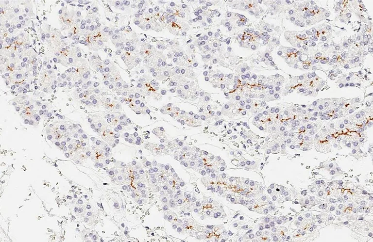 Immunohistochemistry (Formalin/PFA-fixed paraffin-embedded sections) - Anti-GPRC5C antibody [HL3595] - BSA and Azide free (AB325863)