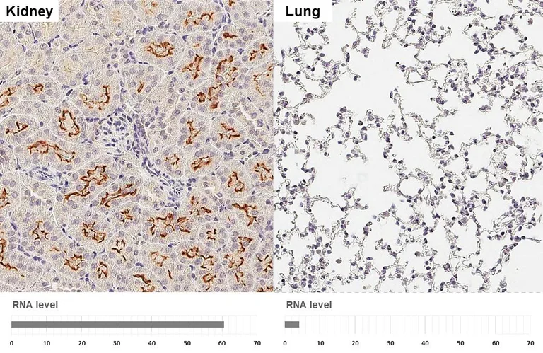 Immunohistochemistry (Formalin/PFA-fixed paraffin-embedded sections) - Anti-GPRC5C antibody [HL3595] - BSA and Azide free (AB325863)