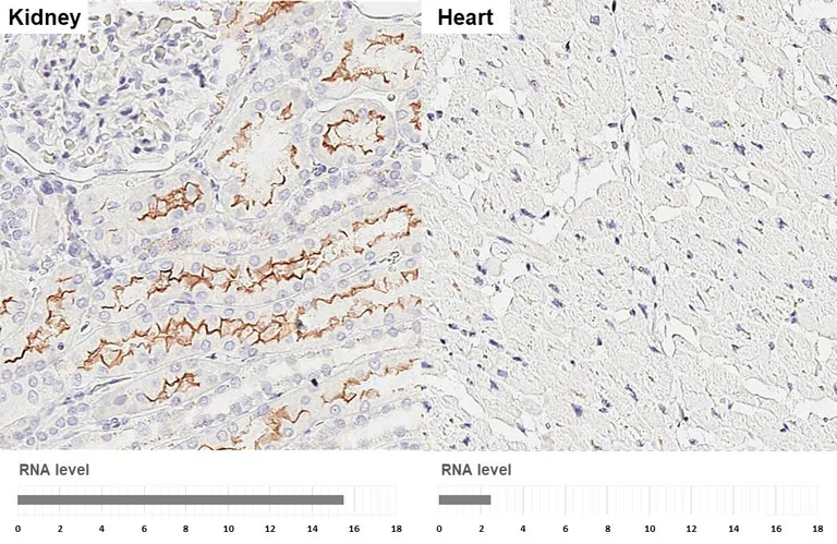 Immunohistochemistry (Formalin/PFA-fixed paraffin-embedded sections) - Anti-GPRC5C antibody [HL3595] - BSA and Azide free (AB325863)