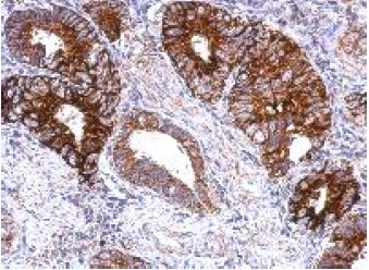 Immunohistochemistry (Formalin/PFA-fixed paraffin-embedded sections) - Anti-GPS2 antibody (AB153986), expandable thumbnail