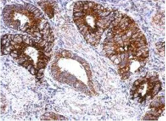 Immunohistochemistry (Formalin/PFA-fixed paraffin-embedded sections) - Anti-GPS2 antibody (AB153986)