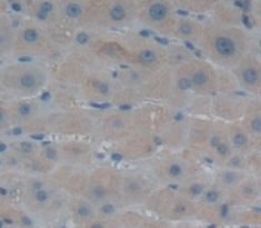 Immunohistochemistry (Formalin/PFA-fixed paraffin-embedded sections) - Anti-GPT2 antibody (AB232963), expandable thumbnail