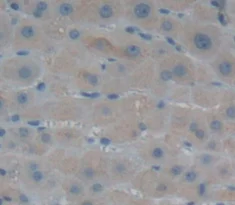 Immunohistochemistry (Formalin/PFA-fixed paraffin-embedded sections) - Anti-GPT2 antibody (AB232963)