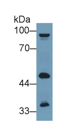 Western blot - Anti-GPT2 antibody (AB232963)