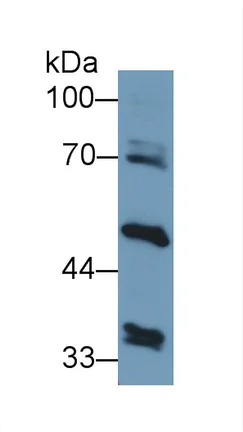 Western blot - Anti-GPT2 antibody (AB232963)
