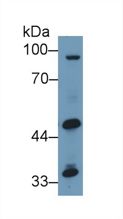 Western blot - Anti-GPT2 antibody (AB232963), expandable thumbnail