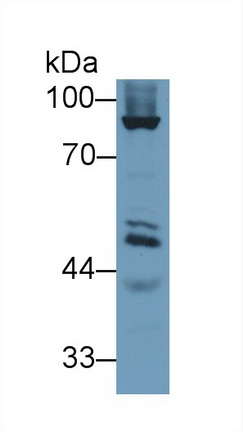 Western blot - Anti-GPT2 antibody (AB232963), expandable thumbnail