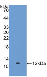 Western blot - Anti-GPT2 antibody (ab232963), expandable thumbnail