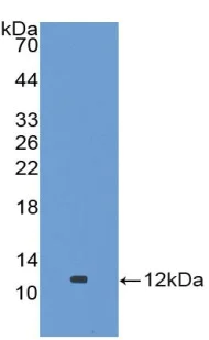 Western blot - Anti-GPT2 antibody (AB232963)