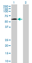 Western blot - Anti-GPT2 antibody (AB69279)