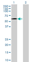 Western blot - Anti-GPT2 antibody (AB69279)