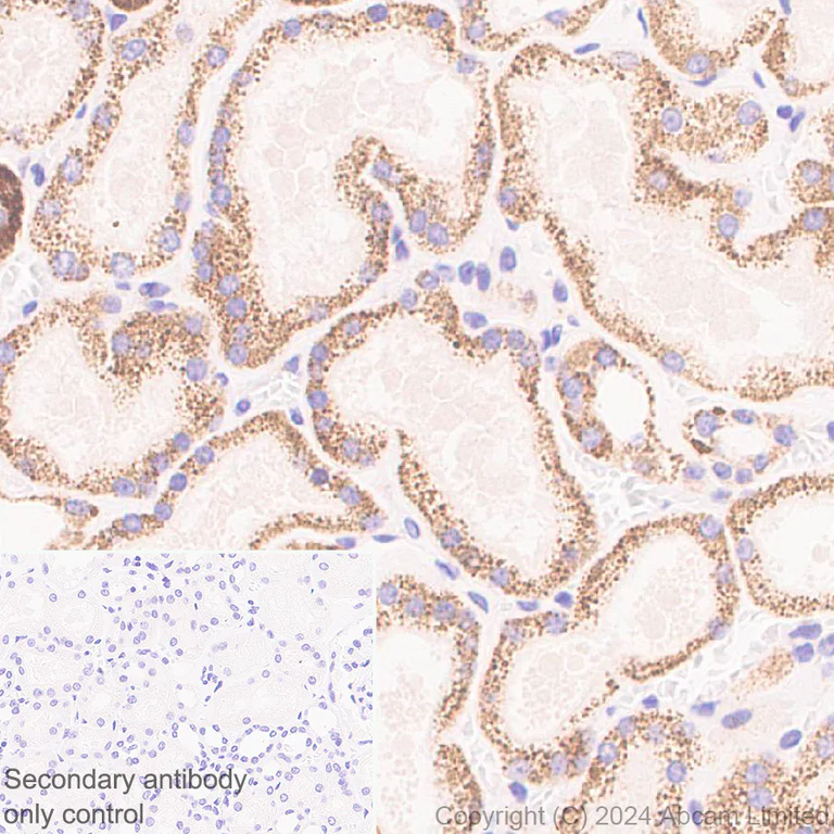 Immunohistochemistry (Formalin/PFA-fixed paraffin-embedded sections) - Anti-GPT2 antibody [EPR29176-18] - BSA and Azide free (AB324833)