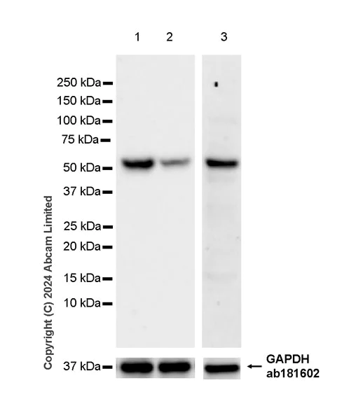 Western blot - Anti-GPT2 antibody [EPR29176-18] - BSA and Azide free (AB324833)