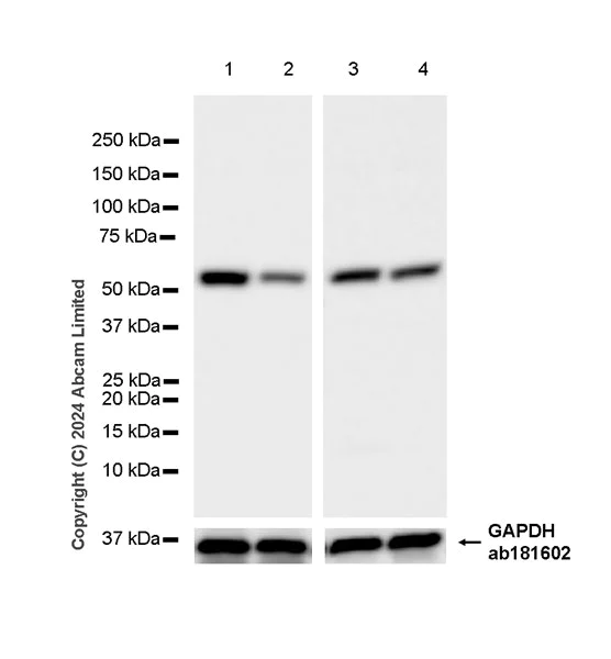 Western blot - Anti-GPT2 antibody [EPR29176-18] - BSA and Azide free (AB324833)