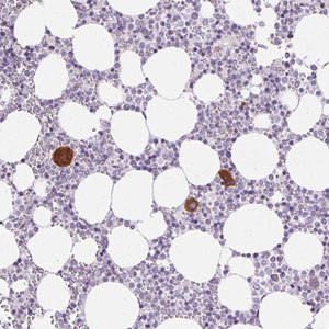 Immunohistochemistry (Formalin/PFA-fixed paraffin-embedded sections) - Anti-GPVI antibody (AB204970)