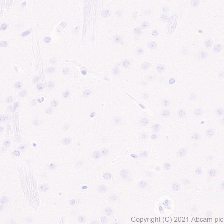 Immunohistochemistry (Formalin/PFA-fixed paraffin-embedded sections) - Anti-GPVI antibody [EPR25283-14] (AB289964)
