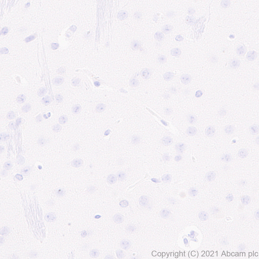 Immunohistochemistry (Formalin/PFA-fixed paraffin-embedded sections) - Anti-GPVI antibody [EPR25283-14] - BSA and Azide free (ab289987), expandable thumbnail