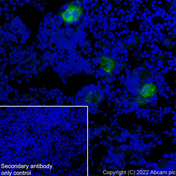 Immunohistochemistry (Frozen sections) - Anti-GPVI antibody [EPR25283-14] - BSA and Azide free (AB289987), expandable thumbnail