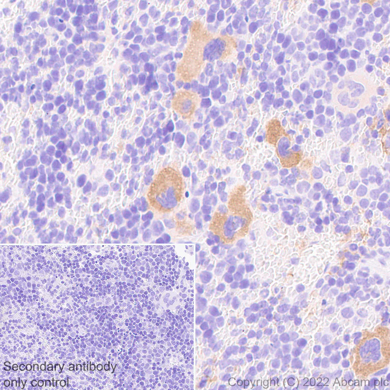 Immunohistochemistry - Anti-GPVI antibody [EPR25690-71] (AB302950)