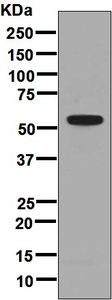 Western blot - Anti-GPVI antibody [EPR8347] (AB129019), expandable thumbnail
