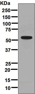 Western blot - Anti-GPVI antibody [EPR8347] - BSA and Azide free (AB248264)