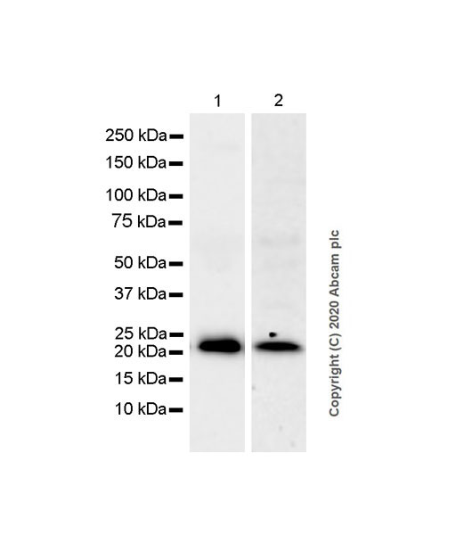 glutathione synthetase deficiency smear Hemolytic Anemia Due to Gamma-Glutamylcysteine Synthetase Deficiency: A  Rare Novel Case in an Arab-Muslim Israeli Child
