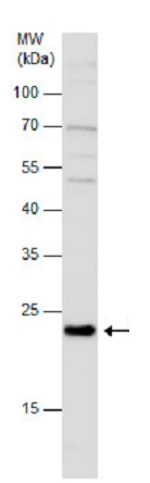 Western blot - Anti-GPx-7 antibody (AB228941)