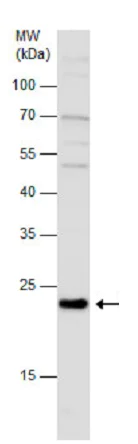 Western blot - Anti-GPx-7 antibody (AB228941)