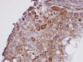 Immunohistochemistry (Formalin/PFA-fixed paraffin-embedded sections) - Anti-GPx-7 antibody (AB96257), expandable thumbnail