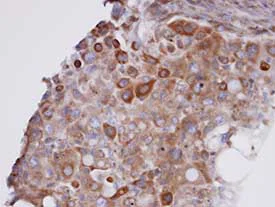 Immunohistochemistry (Formalin/PFA-fixed paraffin-embedded sections) - Anti-GPx-7 antibody (AB96257)