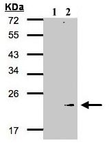 Western blot - Anti-GPx-7 antibody (AB96257), expandable thumbnail