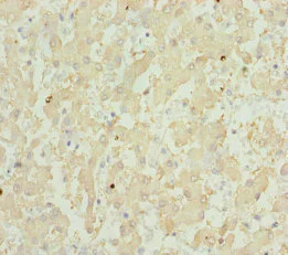Immunohistochemistry (Formalin/PFA-fixed paraffin-embedded sections) - Anti-GPX5 antibody (AB230025)