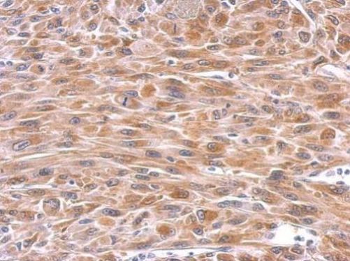 Immunohistochemistry (Formalin/PFA-fixed paraffin-embedded sections) - Anti-GPX8 antibody (AB183664), expandable thumbnail