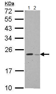 Western blot - Anti-GPX8 antibody (AB183664), expandable thumbnail