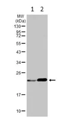 Western blot - Anti-GPX8 antibody (AB183664)