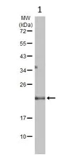 Western blot - Anti-GPX8 antibody (AB183664)