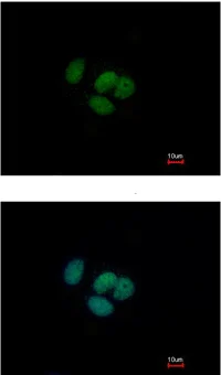 Immunocytochemistry/ Immunofluorescence - Anti-Grainyhead-like protein 1 homolog antibody (AB111582)