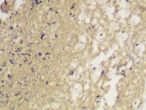 Immunohistochemistry (Formalin/PFA-fixed paraffin-embedded sections) - Gram Stain Kit (Microorganism Stain) (AB150672), expandable thumbnail