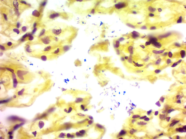 Immunohistochemistry (Formalin/PFA-fixed paraffin-embedded sections) - Gram Stain Kit (Microorganism Stain) (AB150672), expandable thumbnail