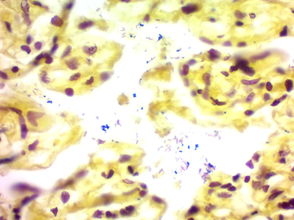 Immunohistochemistry (Formalin/PFA-fixed paraffin-embedded sections) - Gram Stain Kit (Microorganism Stain) (AB150672)