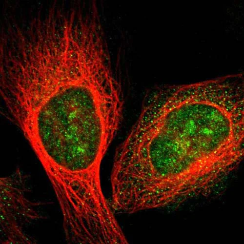 Immunocytochemistry/ Immunofluorescence - Anti-GRAMD1B antibody (AB121286)