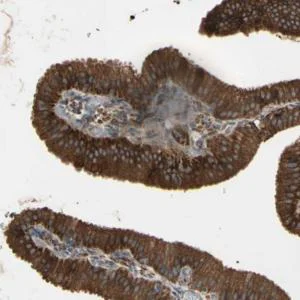 Immunohistochemistry (Formalin/PFA-fixed paraffin-embedded sections) - Anti-GRAMD1B antibody (AB121286)