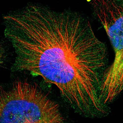 Immunocytochemistry/ Immunofluorescence - Anti-GRAMD1C antibody (AB121365)