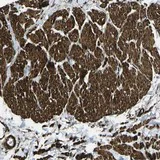 Immunohistochemistry (Formalin/PFA-fixed paraffin-embedded sections) - Anti-GRAMD1C antibody (AB121365)